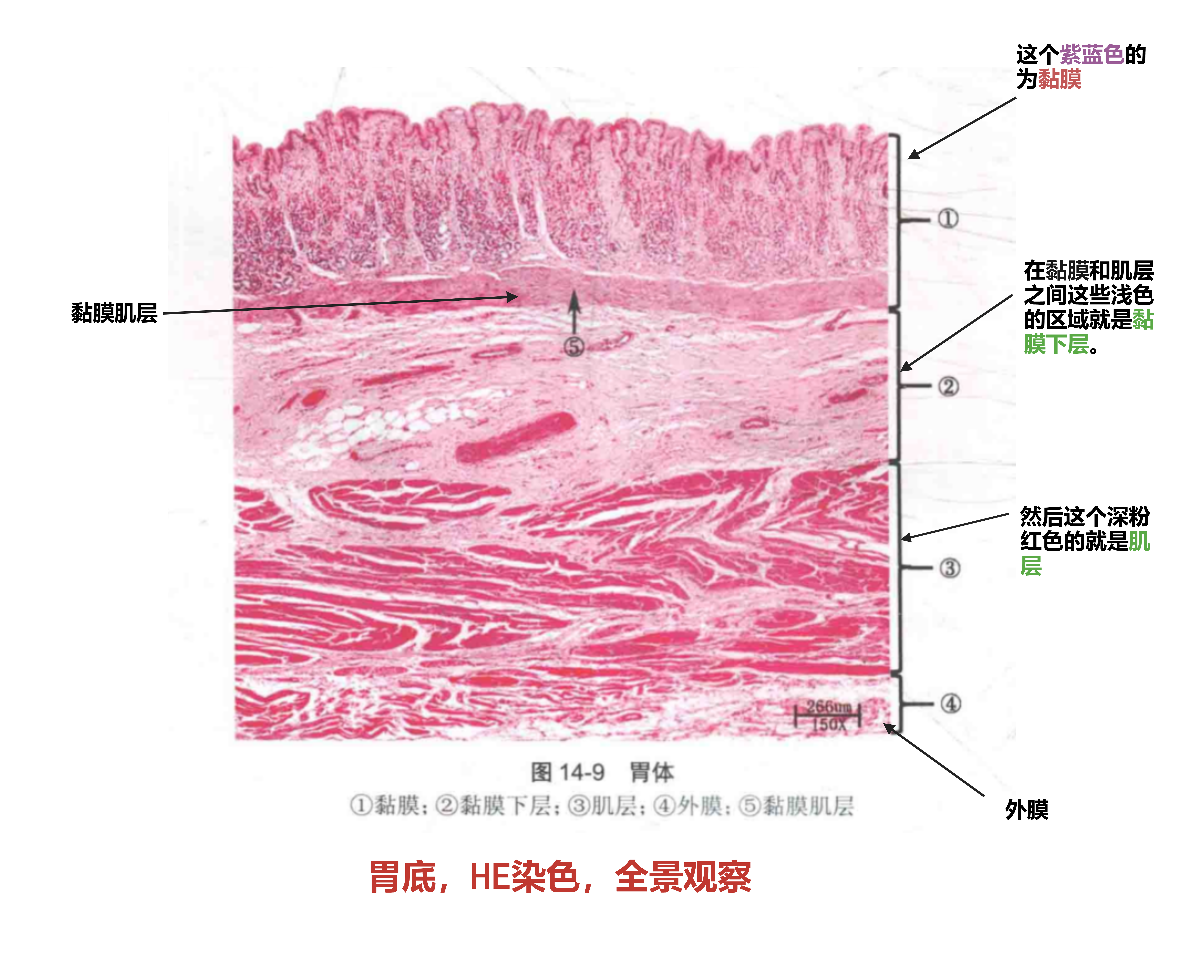 胃HE染色全景观察.png
