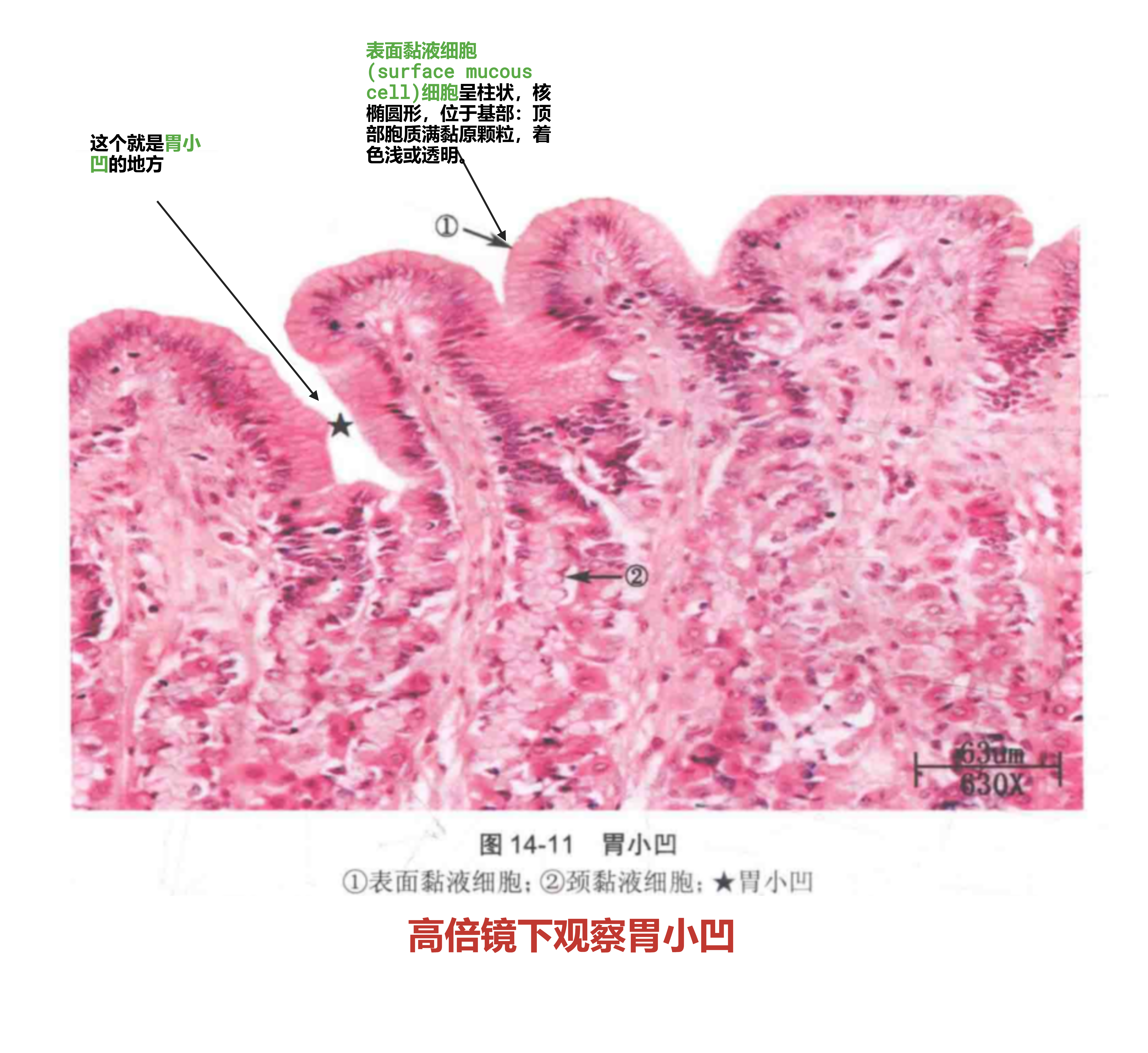 高背景下观察胃小凹.png
